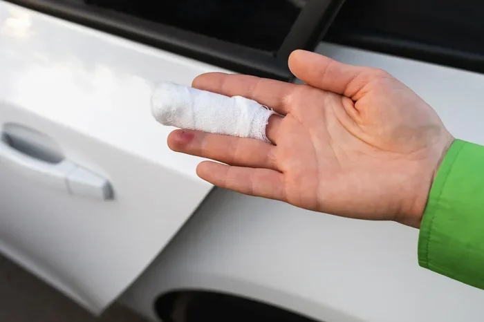 Can a Car Window Break Your Finger and Cause Injury